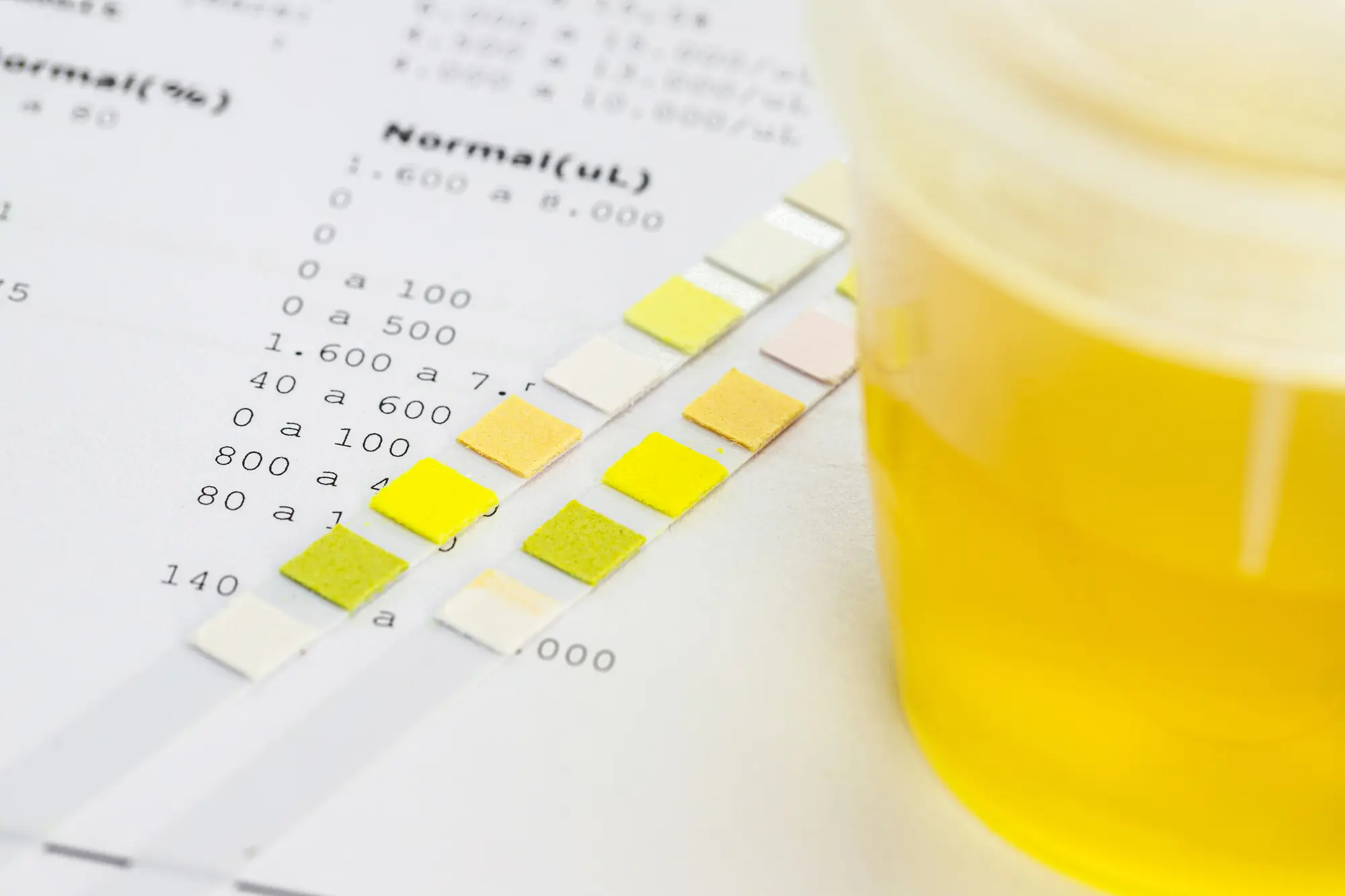 Urindiagnostik – Chemie und Sediment