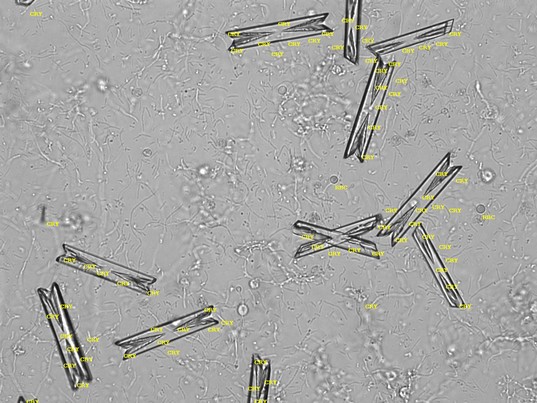 Harnsediment - Auswahlbild 4