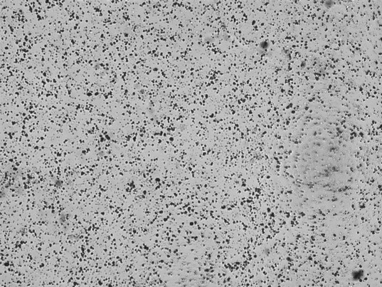 Harnsediment - Auswahlbild 3