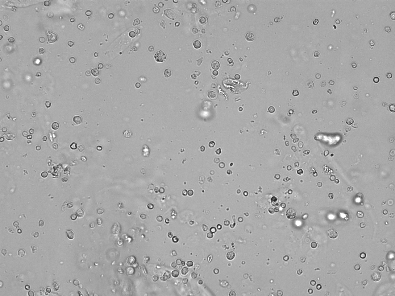 Akantozyten - elearning Angebot