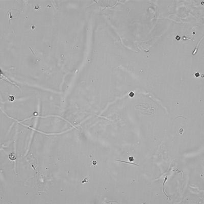 Ca-Oxalate und Spermien