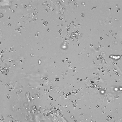 Akantozyten und Tubulusepithelien