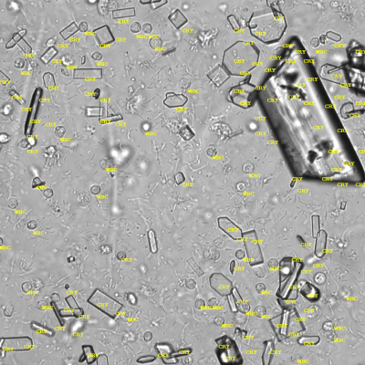 Trippelphosphate