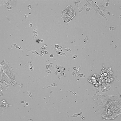 geschwänzte Uroepithelien