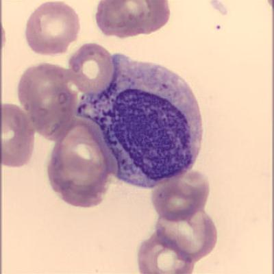 Myelozyt Haema Riegler1