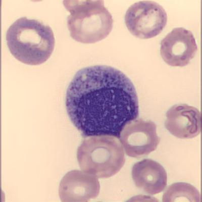 Myelozyt Haema Riegler2