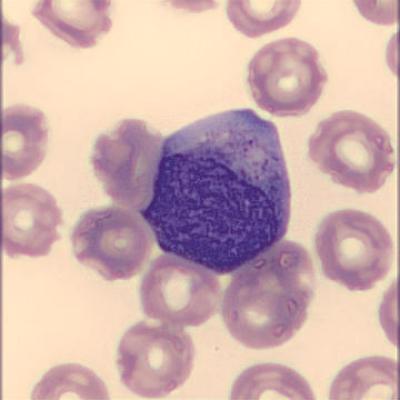 Myelozyt Haema Riegler3