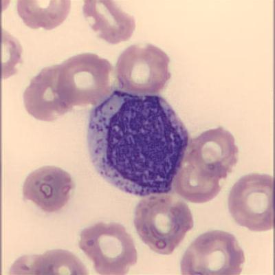 Myelozyt Haema Riegler4