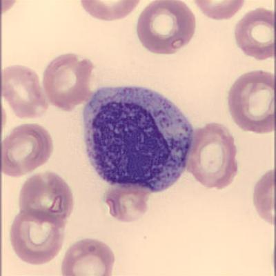 Myelozyt Haema Riegler5