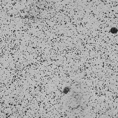 amorphe Urate (pH 5)