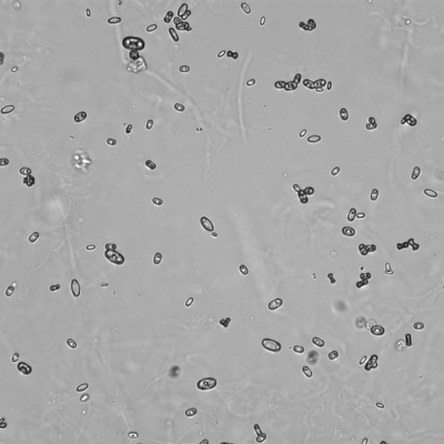 Ca-Oxalate monohydrat