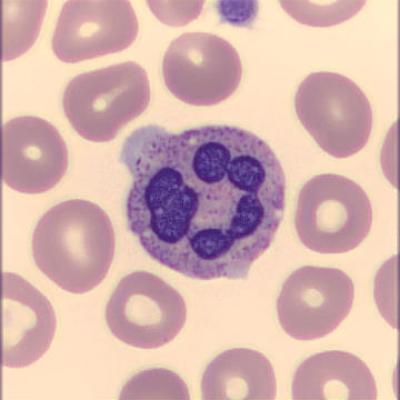 Segmentkernigergranulozyt Haema Riegler2