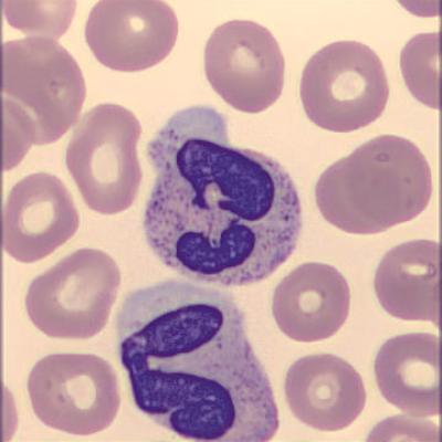 Segmentkernigergranulozyt Haema Riegler3