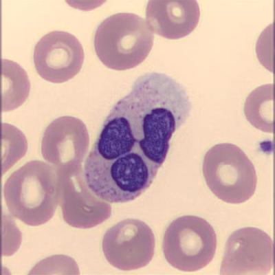 Segmentkernigergranulozyt Haema Riegler4