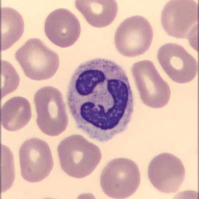 Segmentkernigergranulozyt Haema Riegler5