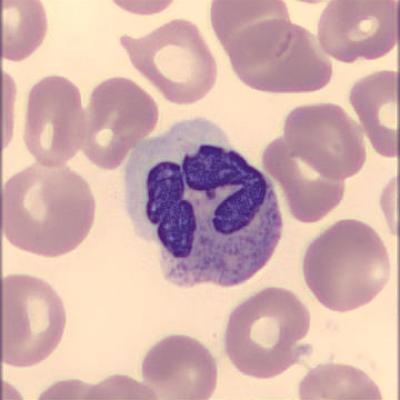 Segmentkernigergranulozyt Haema Riegler6