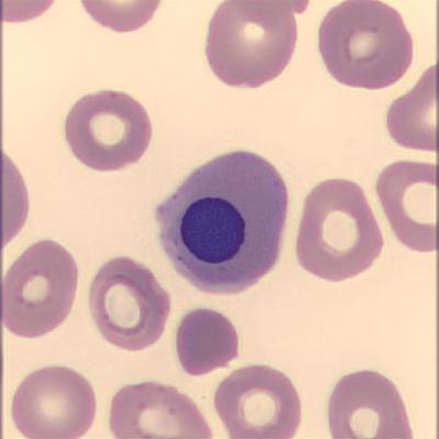 Normoblast Haema Riegler1