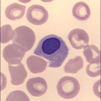 Normoblast Haema Riegler2