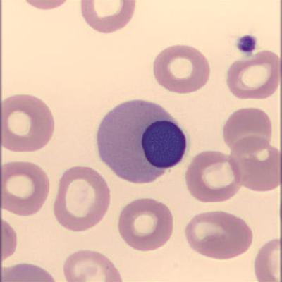 Normoblast Haema Riegler3