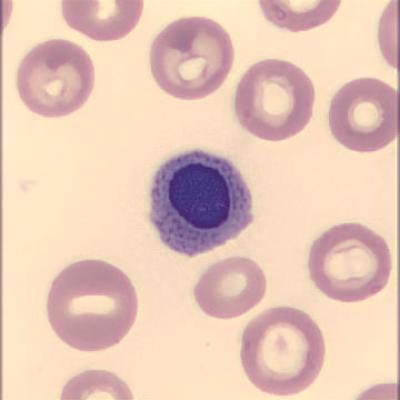 Normoblast Haema Riegler4